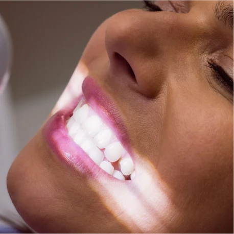 Blanqueamiento dental